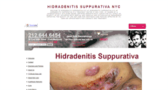 Desktop Screenshot of hidradenitissuppurativanyc.org