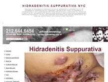 Tablet Screenshot of hidradenitissuppurativanyc.org
